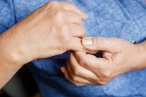 Hands of an senior woman with arthritis closeup