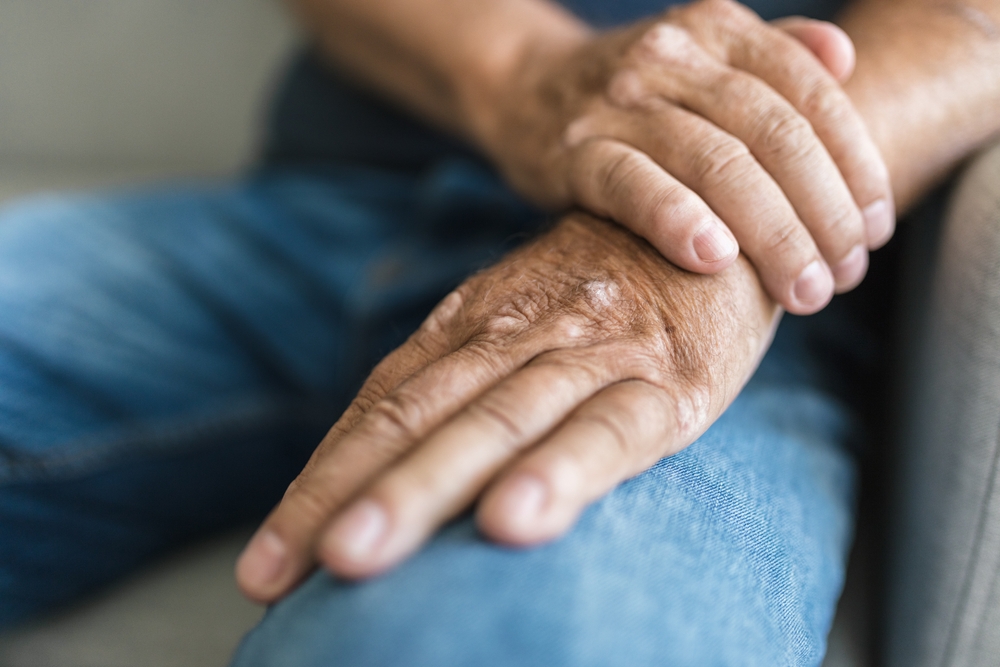 Elderly man suffering from psoriasis, closeup on hands